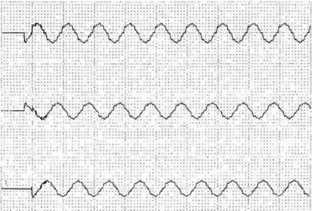 ���l���_(k��i)�P(gu��n)�r(sh��)���ΈD